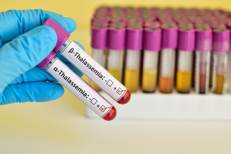 Mang gen bệnh thalassemia vẫn có thể sinh con khoẻ mạnh  - Ảnh 1.