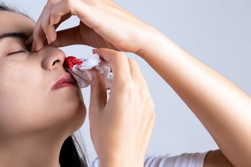 Những dấu hiệu “tố