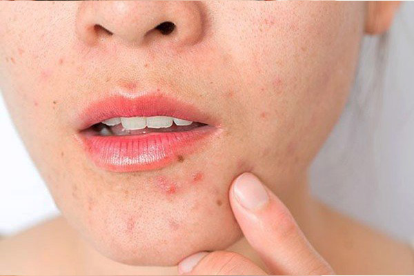 Những dấu hiệu “tố