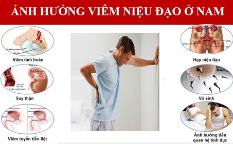 Viêm niệu đạo: Nhận biết sớm để tránh biến chứng nguy hiểm- Ảnh 1. Viêm niệu đạo có nguy hiểm không?