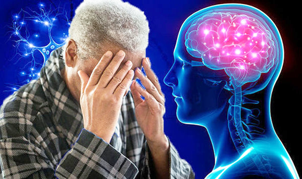 Bệnh Covid-19 có thể gây suy giảm nhận thức và các biểu hiện giống bệnh Alzheimer - Ảnh 2.