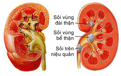 Uống nhiều nước nhưng sai cách gây hại cho đường tiết niệu- Ảnh 3.