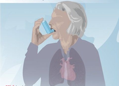 5 điều cần biết đối với người mắc phổi tắc nghẽn mạn tính khi thời tiết chuyển mùa  - Ảnh 2.