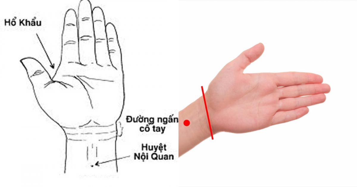 Bấm huyệt trị mất ngủ - Ảnh 2.
