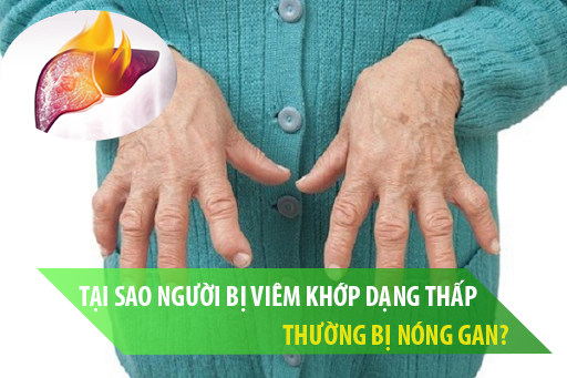 Điều trị viêm khớp dạng thấp thường xuyên bị nóng gan, làm sao để cải thiện? - Ảnh 1.