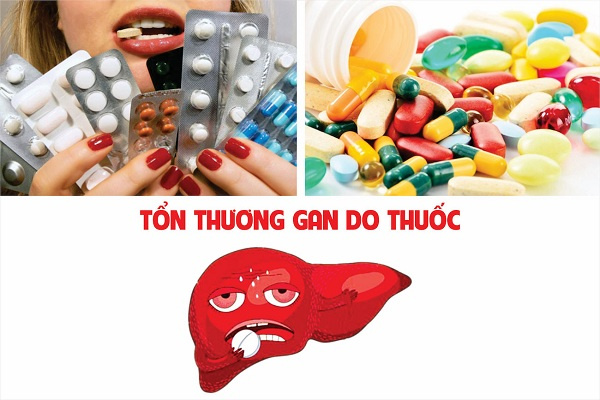 Bệnh mạn tính và con đường dẫn đến viêm gan - Ảnh 2.