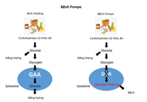 Thuốc mới trị bệnh rối loạn thần kinh cơ - Ảnh 1.