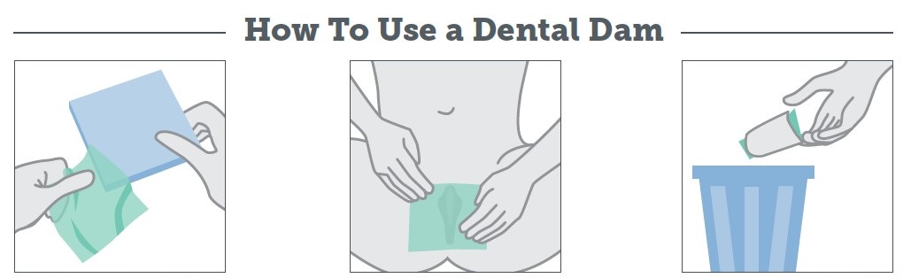 Cách nào quan hệ tình dục an toàn cho người đồng tính? - Ảnh 4.