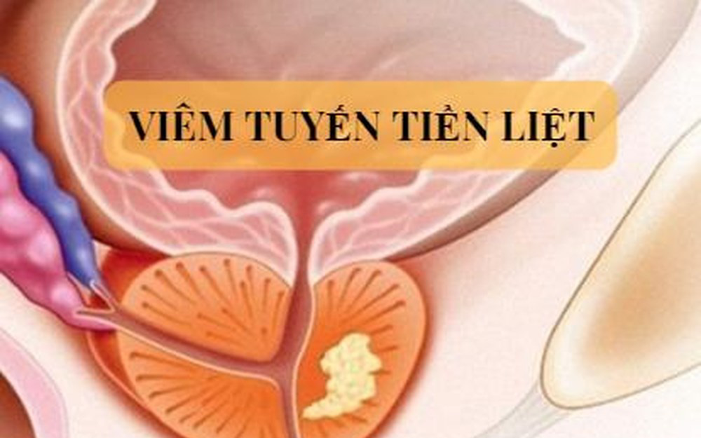 4 món cháo thuốc tốt cho người viêm tuyến tiền liệt