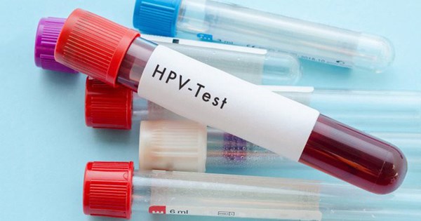 Cảnh báo: Gia tăng các bệnh ung thư liên quan đến virus HPV - Ảnh 3.