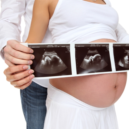 3 thời điểm siêu âm quan trọng thai phụ cần nhớ - Ảnh 4.