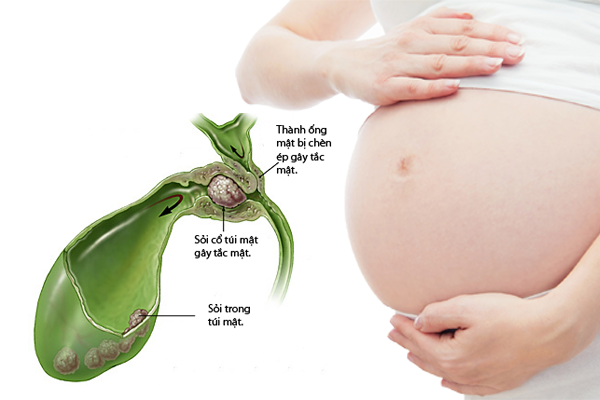 Những vị trí đau bụng khi mang thai nào cần lưu ý - Ảnh 5.
