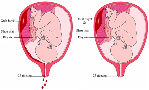 Suy giáp có thể ảnh hưởng như thế nào đến việc mang thai - Ảnh 4.