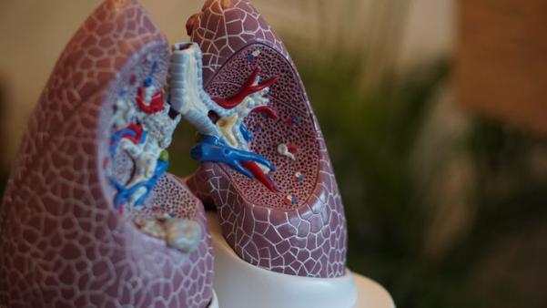 Nghiên cứu liệu pháp chống lại bệnh viêm phổi không cần dùng kháng sinh - Ảnh 1.