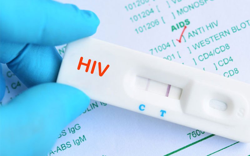 Bạn có biết: Xét nghiệm HIV hoàn toàn miễn phí  