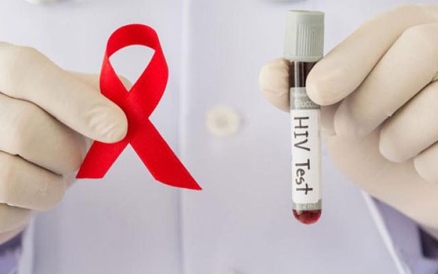 Kết quả xét nghiệm HIV được bảo mật hoàn toàn