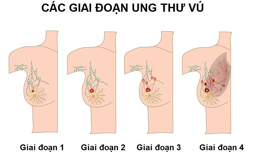 3. Các yếu tố môi trường và lối sống