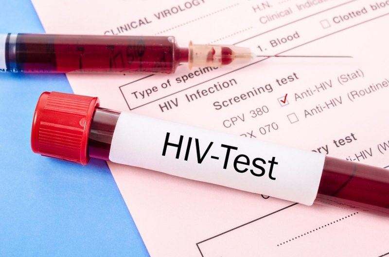 Ghi nhận biến thể mới có độc lực cao của virus HIV tại Hà Lan  Khoa học   Vietnam VietnamPlus