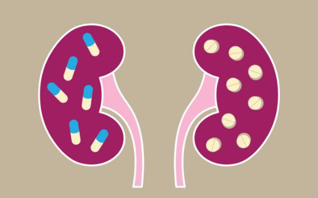 Tổn thương thận âm thầm từ thực phẩm chức năng và vitamin ‘tốt cho sức khỏe’- Ảnh 3. 4 loại thuốc nếu lạm dụng, tăng nguy cơ tổn thương thận