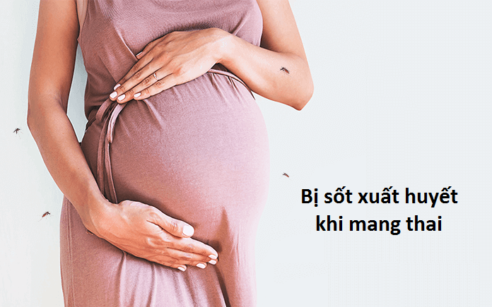 Sốt xuất huyết nguy hiểm với phụ nữ mang thai, xử trí thế nào để ngừa biến chứng?