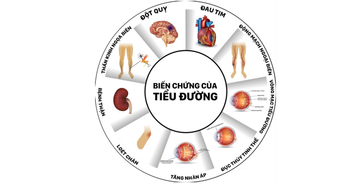 Khuyến cáo mới trong điều trị đái tháo đường  - Ảnh 1.