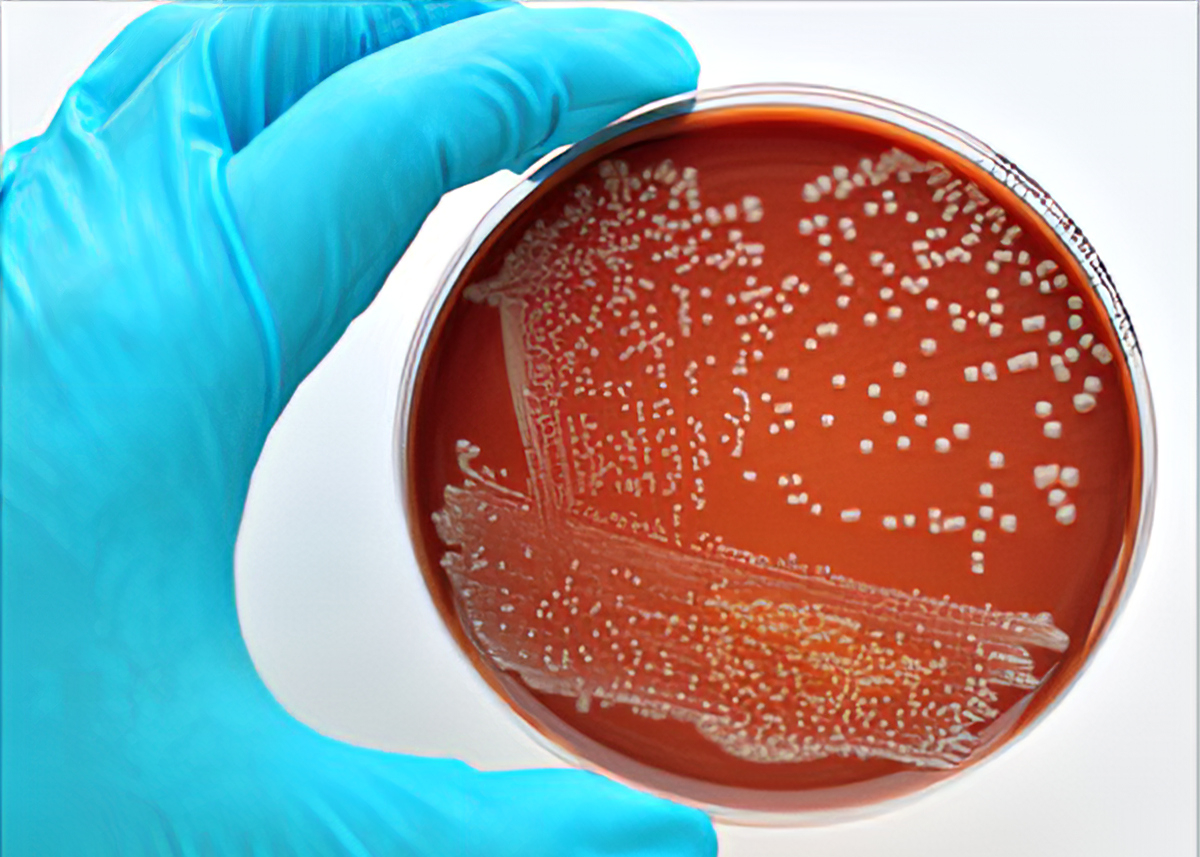 Vi khuẩn E.Coli không 'lành' như bạn vẫn nghĩ và 5 chìa khóa phòng ngộ độc  thực phẩm