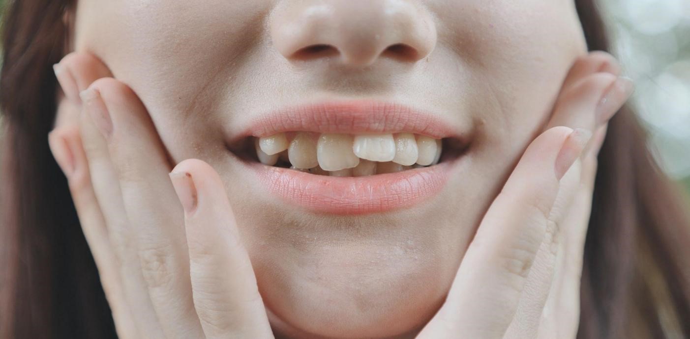 Răng lệch và không đều là một vấn đề phổ biến ở nhiều người. Hãy xem hình ảnh liên quan để tìm hiểu cách điều chỉnh răng miệng một cách hiệu quả, để bạn có thể có được hàm răng đẹp và khỏe mạnh.