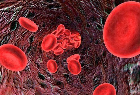 Làm gì để người bệnh hemophilia được tiếp cận điều trị dự phòng chảy máu nhiều hơn? - Ảnh 1.