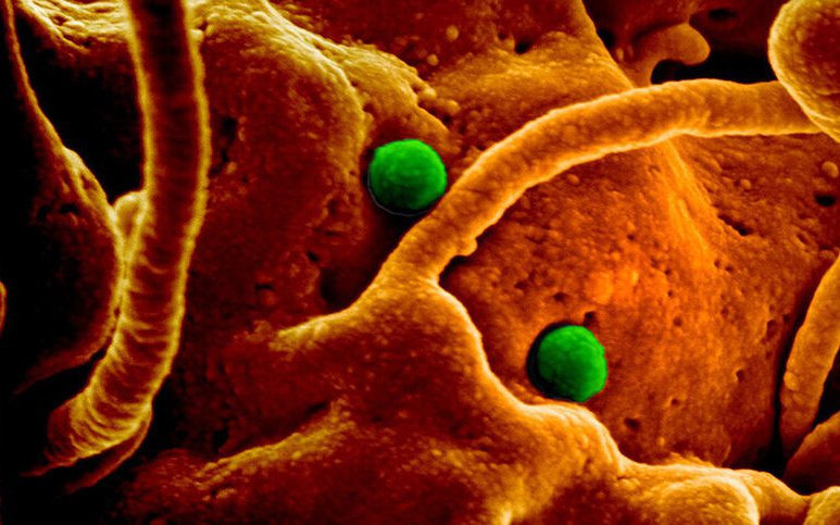"Cúm lạc đà" - Hội chứng hô hấp Trung Đông coronavirus (MERS-CoV), phòng ngừa thế nào?