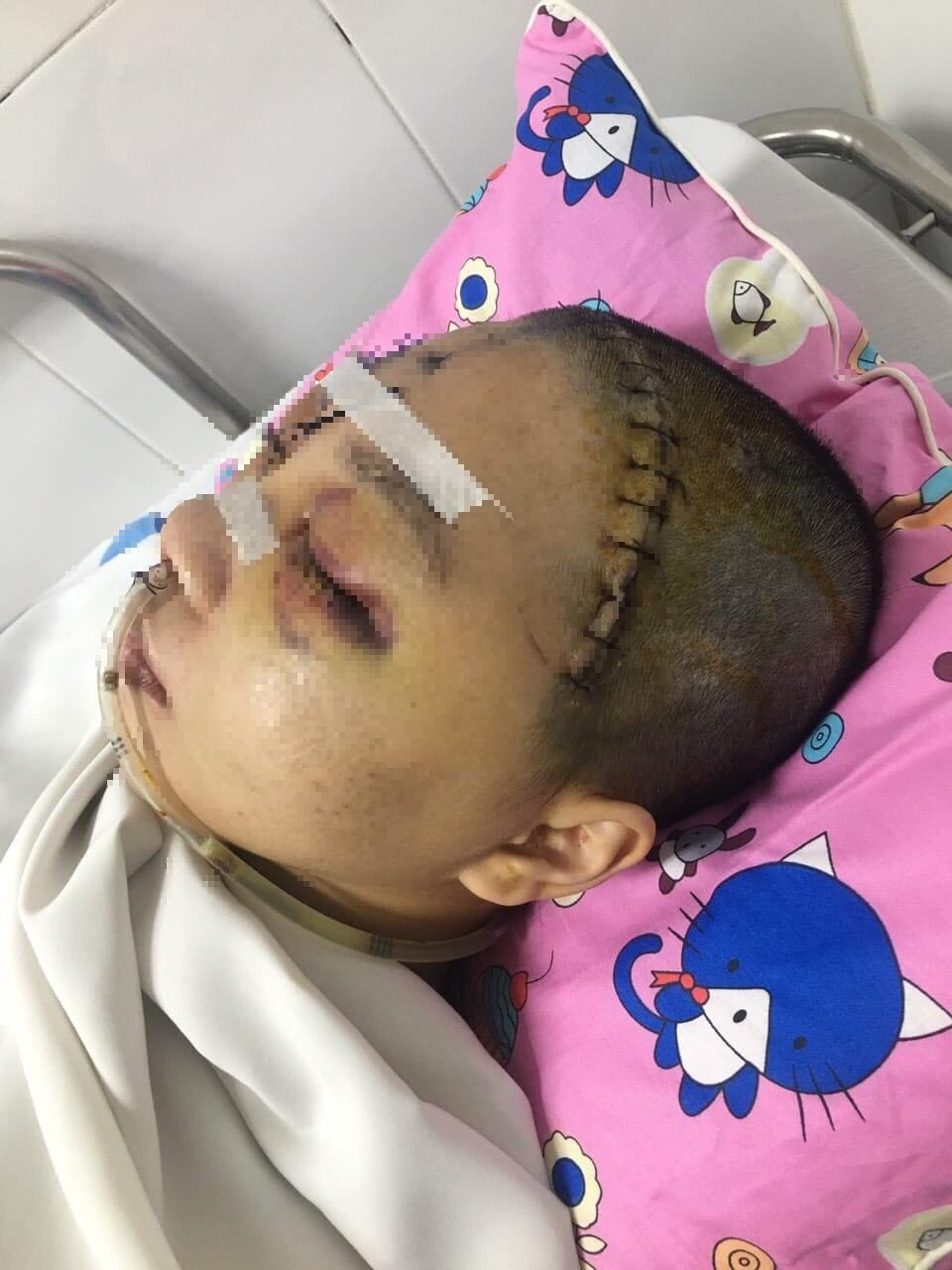 MS 808: Ám ảnh cánh tay cầu cứu của người mẹ vừa tai nạn xong, con gái học trường Y giờ hôn mê sâu vì chấn thương sọ não nặng - Ảnh 3.