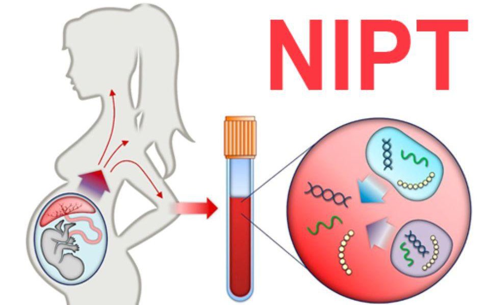 Xét nghiệm NIPT khi mang thai là gì và nên thực hiện ở đâu?