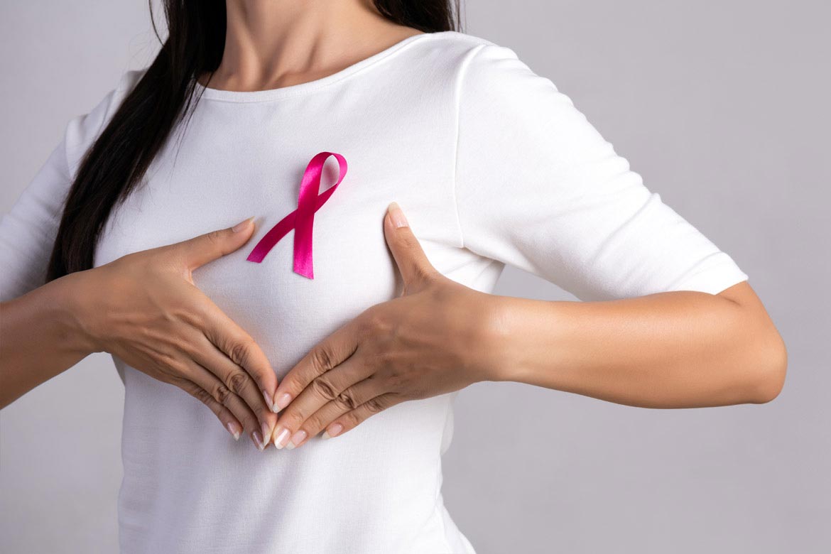 Không chủ quan với khối u vú lành tính để ngừa nguy cơ ung thư - Ảnh 2.