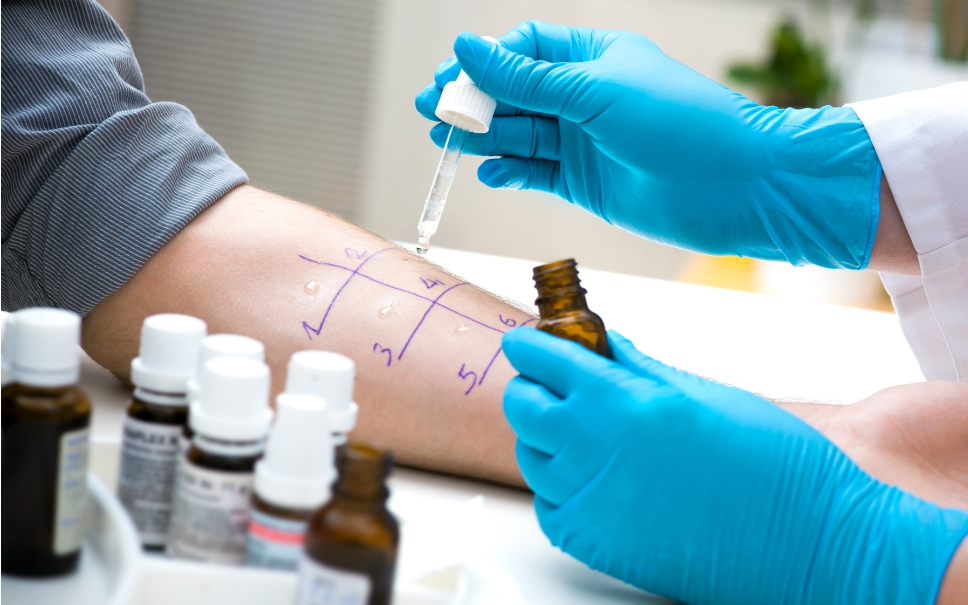 Vì sao cần test dị ứng thuốc kháng sinh penicillin?