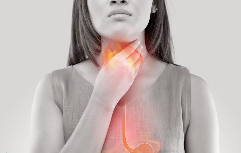 Ợ chua tái phát nhiều lần cảnh báo điều gì về sức khỏe?- Ảnh 2.