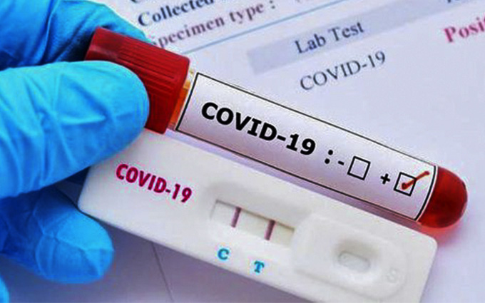 Chiều 26/2: Nhu cầu test xét nghiệm COVID-19, máy SpO2 tăng cao, Bộ Y tế yêu cầu đảm bảo nguồn cung