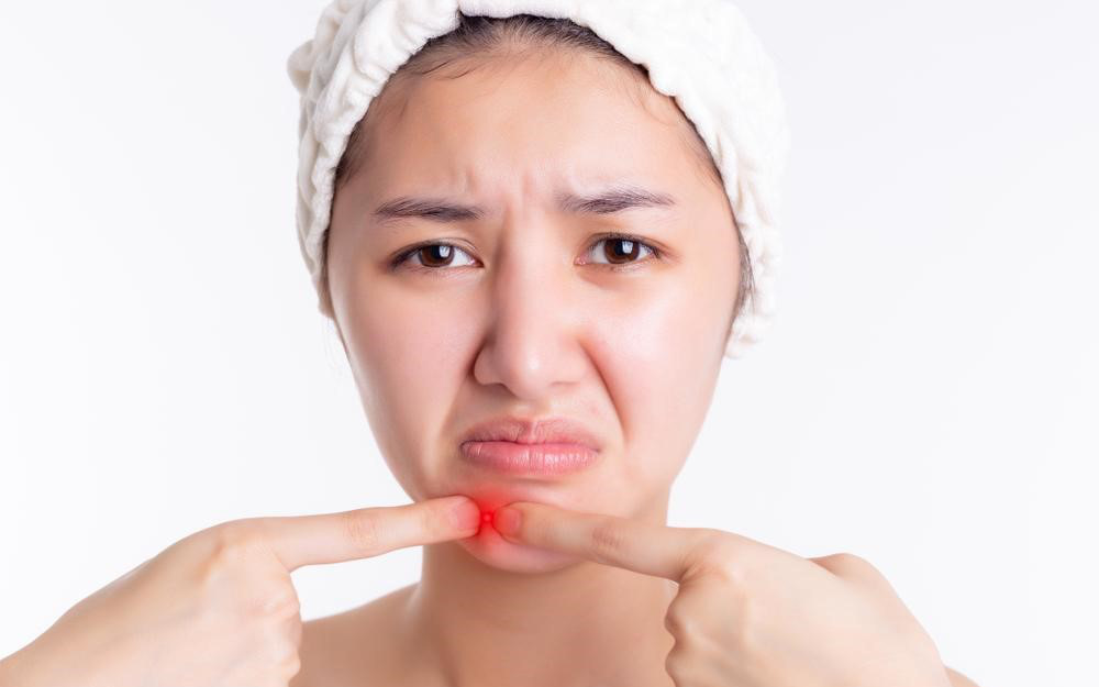 Nguyên nhân gây mụn đinh râu và cách nhận biết sớm để phòng biến chứng - Ảnh 1.