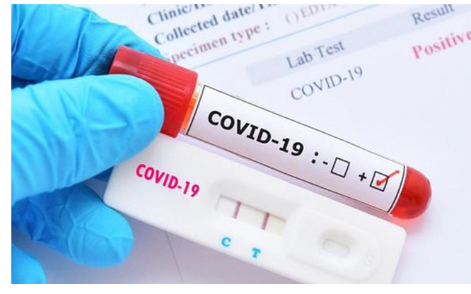 Cơ sở y tế tư nhân không được lợi dụng dịch bệnh để tăng giá xét nghiệm COVID-19
