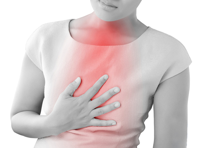 Ợ chua do đâu và cách xử trí?- Ảnh 2.