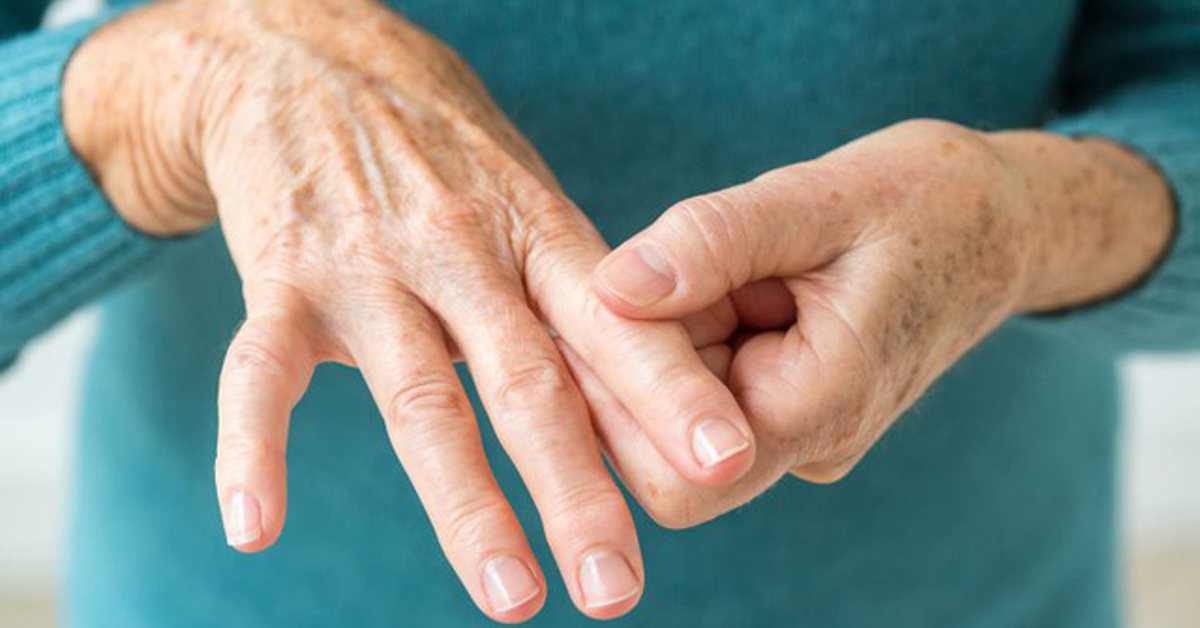 Viêm khớp dạng thấp có chữa khỏi được không?- Ảnh 2.