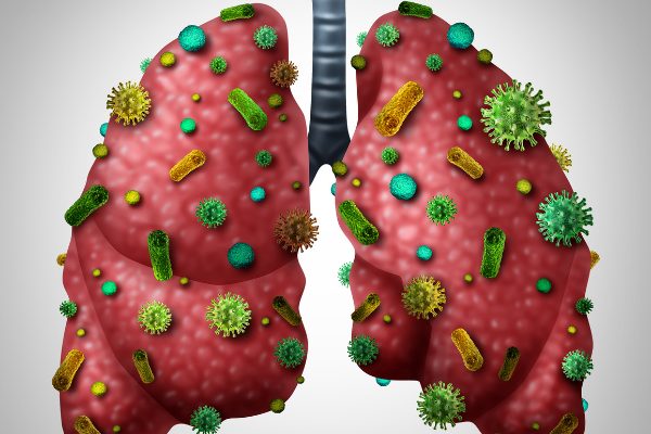 Viêm phổi ở trẻ tái phát nhiều lần và hướng xử trí - Ảnh 4.