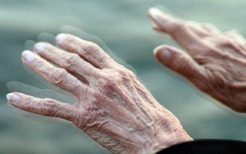 Parkinson và mối liên hệ chặt chẽ giữa vi khuẩn đường ruột  Bệnh viện đa  khoa TTH Vinh