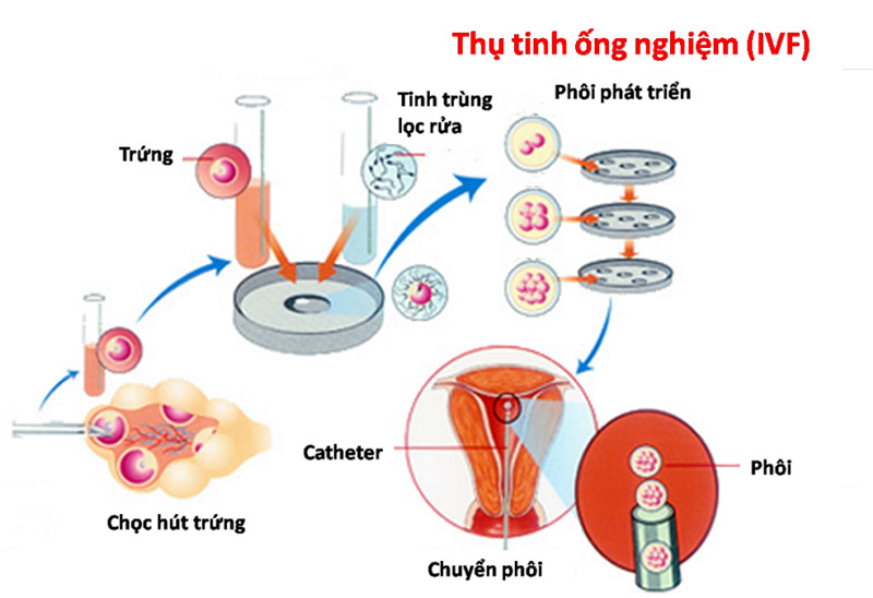 5 yếu tố quyết định tới tỷ lệ thành công thụ tinh trong ống nghiệm - Ảnh 1.