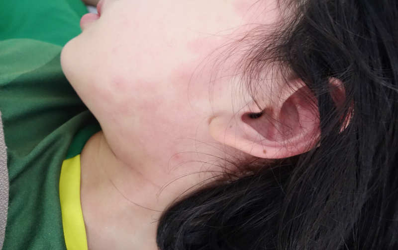 Hai cháu bé ở Quảng Ninh mắc hội chứng COVID-19 hiếm gặp - Ảnh 1.