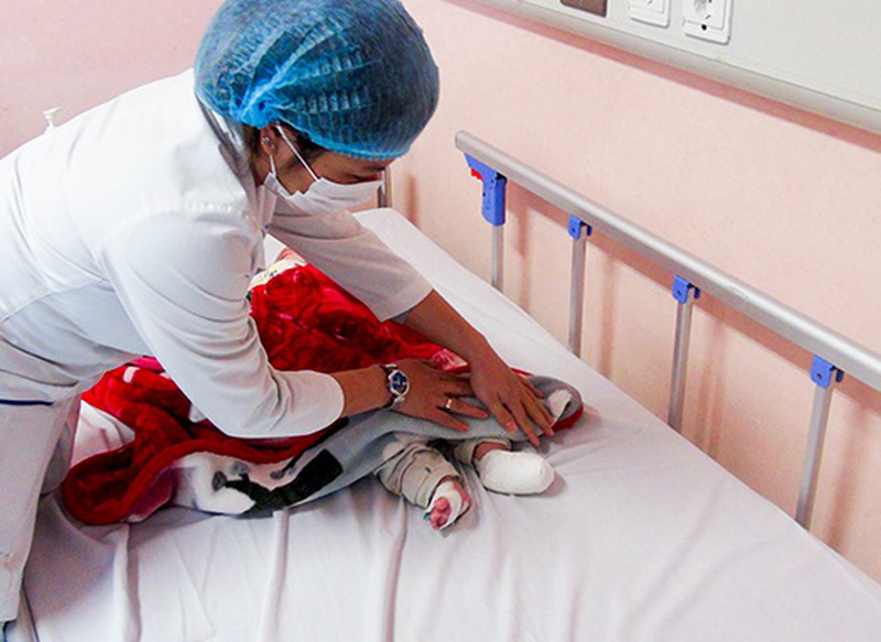 Người lớn xông phòng do lo sợ COVID-19, trẻ 6 tháng tuổi ở Hà Nội bị nhiễm trùng máu sau bỏng - Ảnh 1.