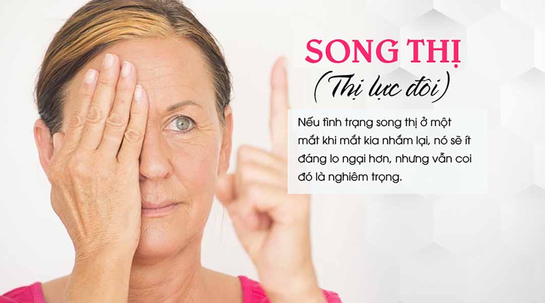 Người bệnh gặp triệu chứng song thị với biểu hiện nhìn đôi và mỏi mắt kéo dài trong sinh hoạt hàng ngày
