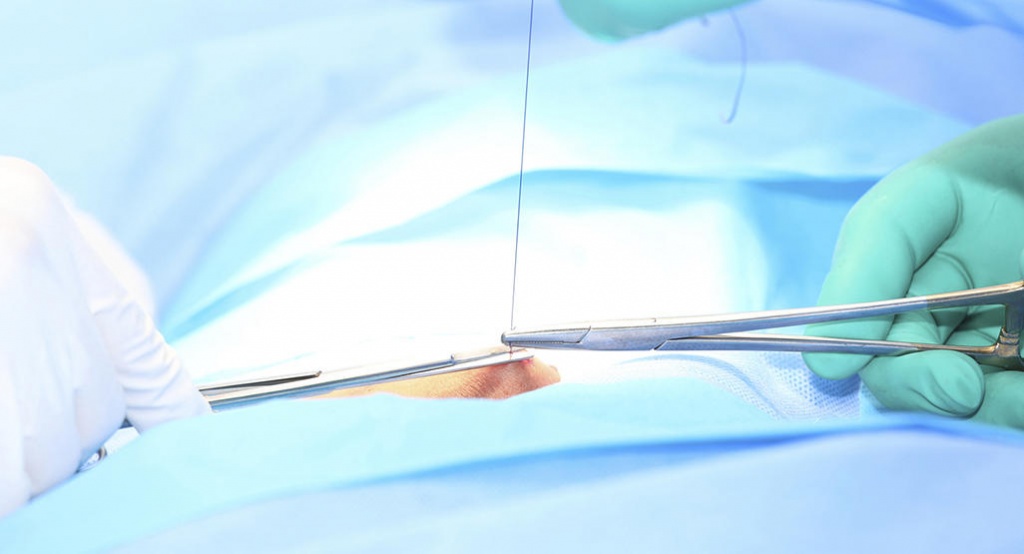 Rạch tầng sinh môn là thủ thuật rạch một đường ngắn ở vùng giữa âm đạo và hậu môn trong quá trình sinh để em bé có thể ra ngoài dễ hơn. Rạch tầng sinh môn là thủ thuật rạch một đường ngắn ở vùng giữa âm đạo và hậu môn trong quá trình sinh để em bé có thể ra ngoài dễ hơn.