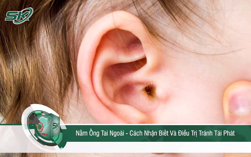 Nấm ống tai ngoài - Cách nhận biết và điều trị, tránh tái phát