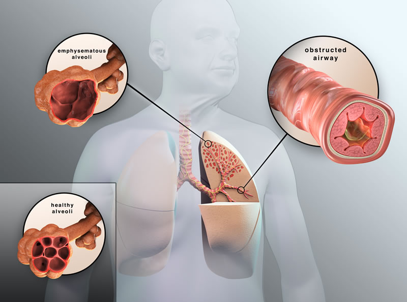 Phần mới của cơ thể được tìm thấy ẩn trong phổi - Ảnh 5.