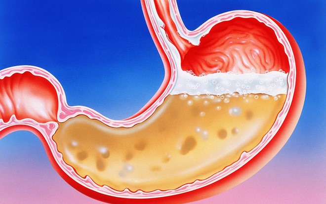 Điểm mặt các dấu hiệu bất thường về đau dạ dày cần tới bác sĩ
