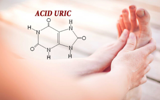 Nồng độ acid uric cao và bệnh gout có liên quan gì đến nhau?